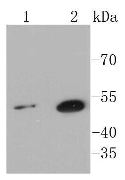 Western blot analysis of Sonic Hedgehog Protein on different lysates using anti-Sonic Hedgehog Protein antibody at 1/1,000 dilution