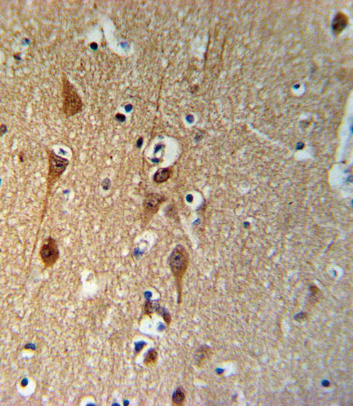 a00059 anti smad3 s208 antibody ihc p testing 3