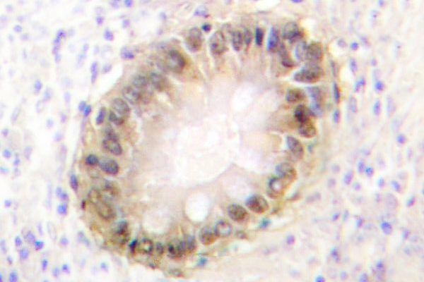a00059s2 smad3 primary antiboties ihc testing 2