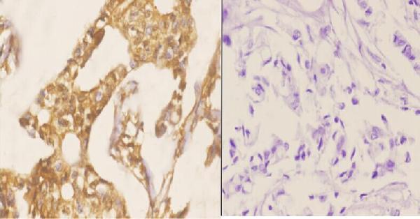 a00059s204 1 smad3 primary antiboties ihc testing 2