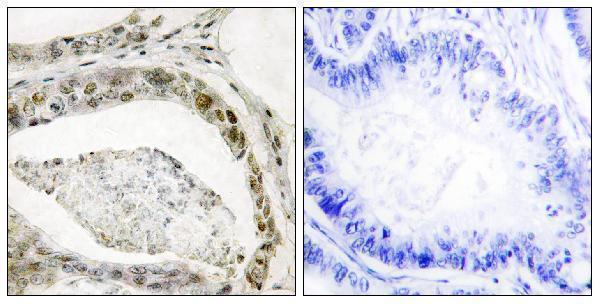 a00059s208 smad3 primary antibodies ihc testing 4