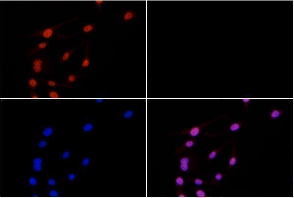a00059s213 smad3 primary antiboties if testing 3