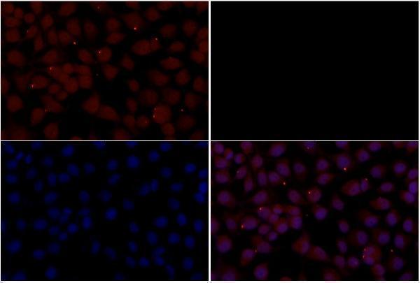 a00059s425 smad3 primary antiboties if testing 3