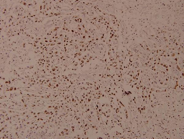 a00059s425 smad3 primary antiboties ihc testing 2
