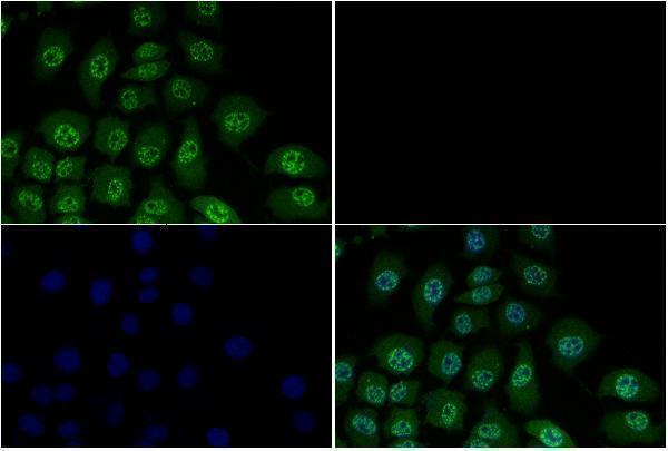 a00059t8 smad3 primary antiboties if testing 2