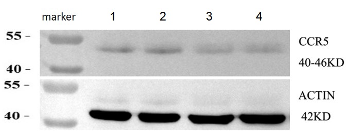  Western blot analysis of CCR5 using anti-CCR5 antibody (A00061-2)