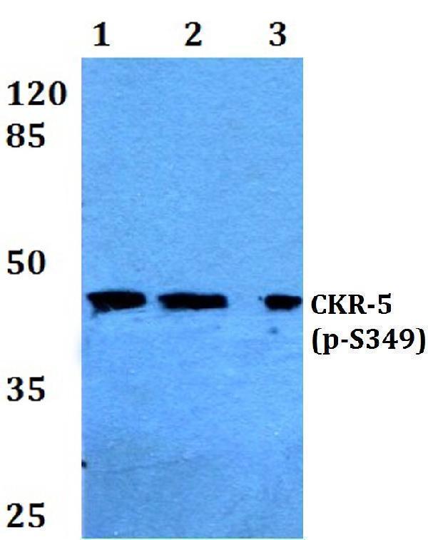 Western blot (WB) analysis of p-CKR-5 (S349) polyclonal antibody at 1:500 dilution
Lane1:Hela cell lysate treated with PMA(100nM,15mins)
Lane2:sp2/0 cell lysate treated with PMA(100nM,15mins)
Lane3:PC12 cell lysate treated with PMA(100nM,15mins)