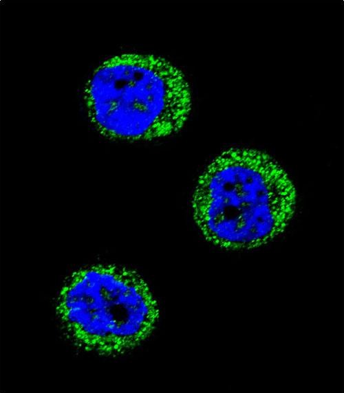 Confocal immunofluorescent analysis of HP Antibody (Center) with MDA-MB435 cell followed by Alexa Fluor 488-conjugated goat anti-rabbit lgG (green)