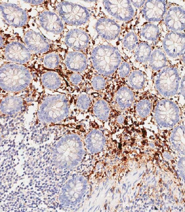 a00062 3 anti hp antibody center ihc p leica testing 4