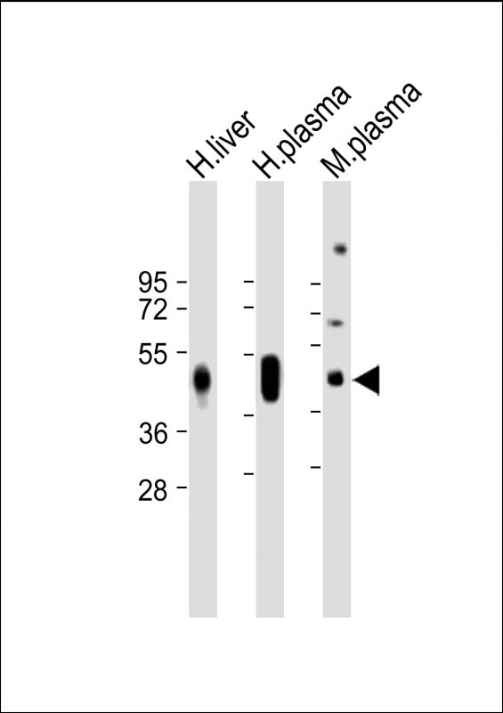 All lanes : Anti-HP Antibody (Center) at 1:1000-1:2000 dilutionLane 1: Human liver lysateLane 2: Human plasma lysateLane 3: Mouse plasma lysateLysates/proteins at 20 µg per lane