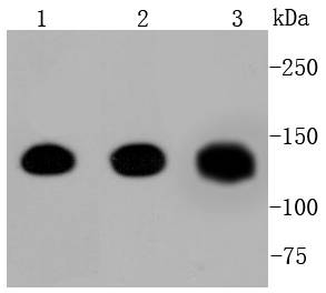 Western blot analysis of Pan-Cadherin on different lysates using anti-Pan-Cadherin antibody at 1/1,000 dilution