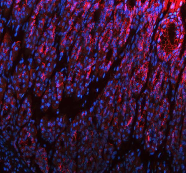 a00063 3 cdh1 primary antibodies if testing 7