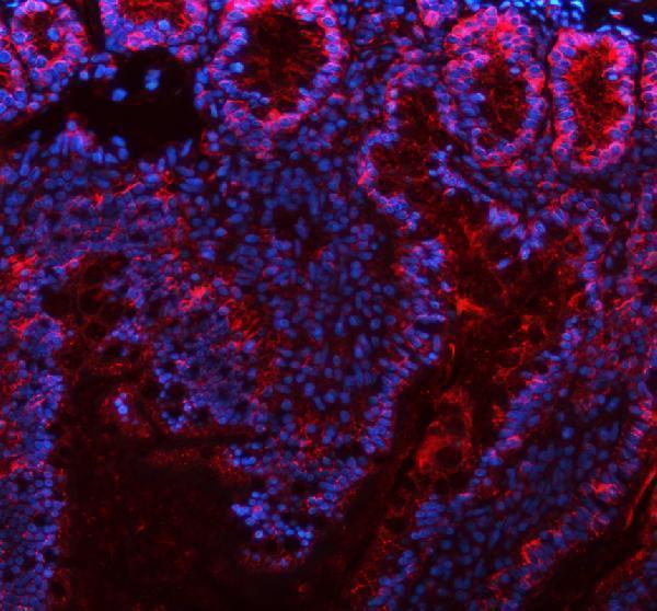 a00063 3 cdh1 primary antibodies if testing 8