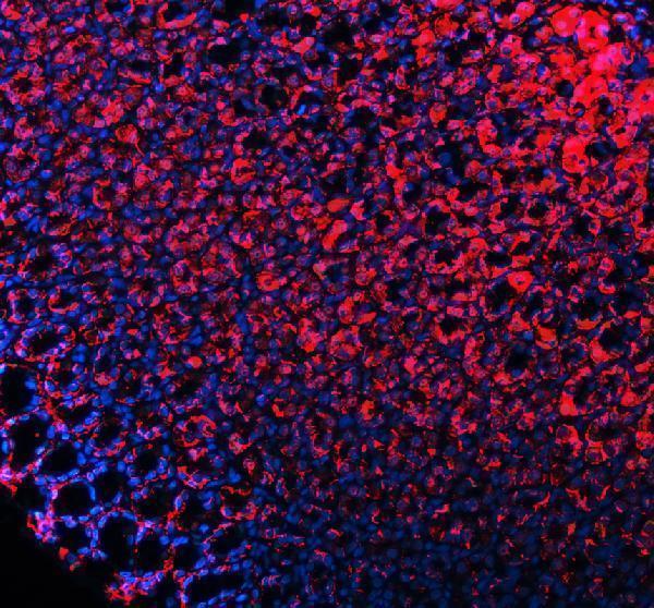 a00063 3 cdh1 primary antibodies if testing 9