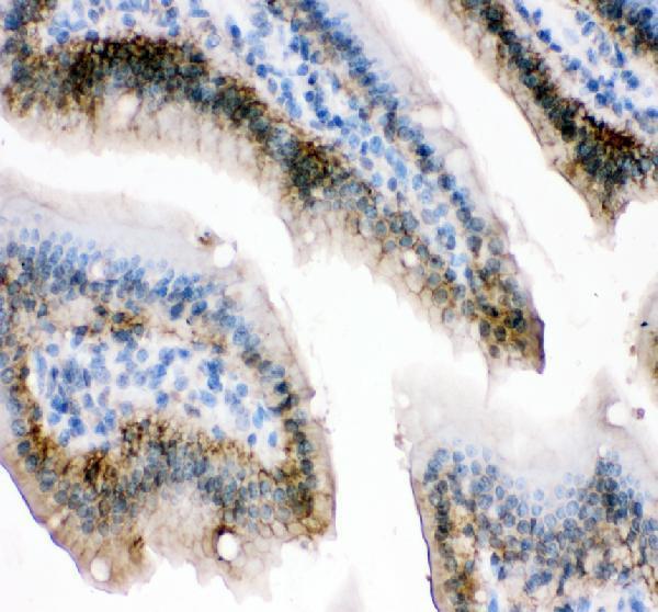  IHC analysis of E-Cadherin/Cdh1 using anti-E-Cadherin/Cdh1 antibody (A00063-3)