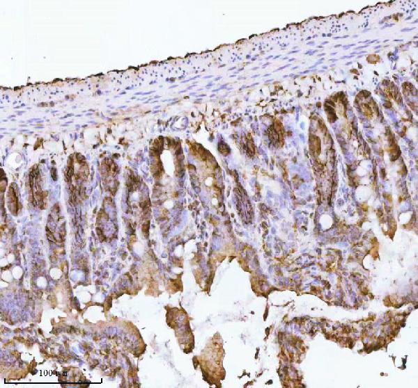  IHC analysis of E-Cadherin/Cdh1 using anti-E-Cadherin/Cdh1 antibody (A00063-3)