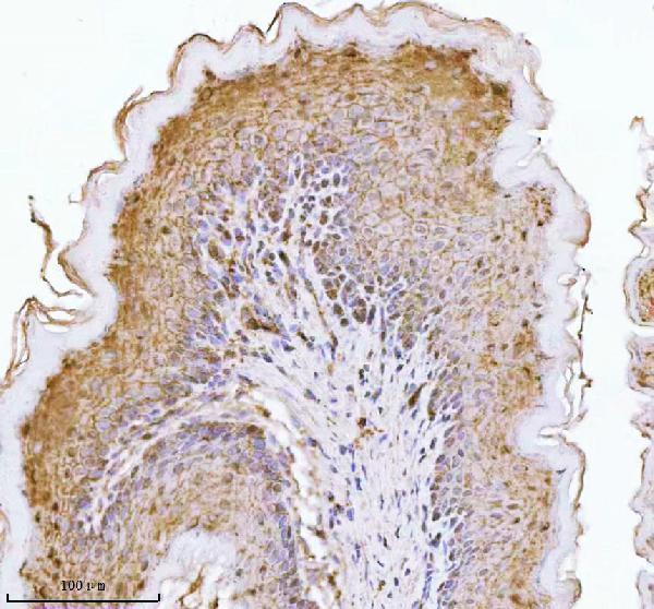 a00063 3 cdh1 primary antibodies ihc testing 5