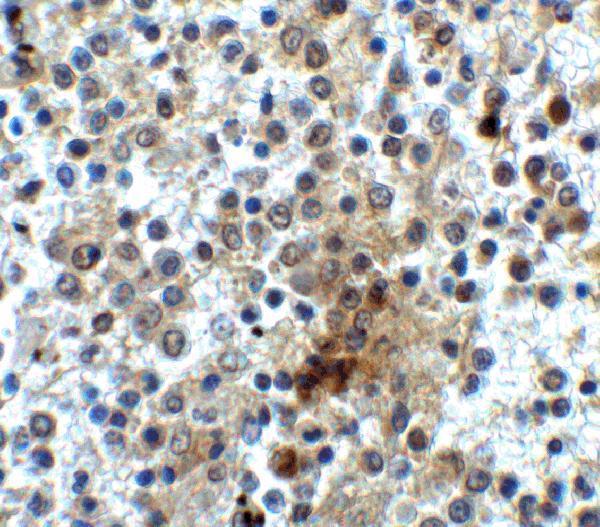 Immunohistochemistry of CD28 in human spleen tissue with CD28 antibody at 2 μg/ml