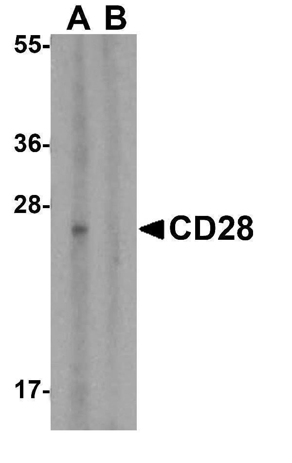 Western blot analysis of CD28 in human spleen tissue lysate with CD28 antibody at 1 μg/mL in (A) the absence and (B) the presence of blocking peptide