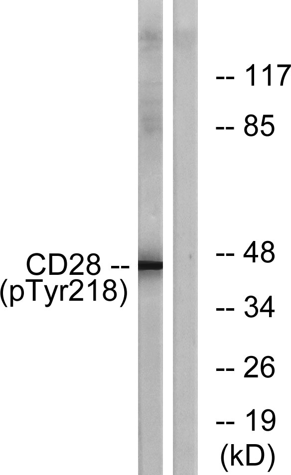 Western blot analysis of lysates from HepG2 cells treated with nocodazole 1ug/ml 16h, using CD28 (Phospho-Tyr218) Antibody