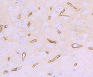 a00069 1 dmd primary antiboties ihc testing 2