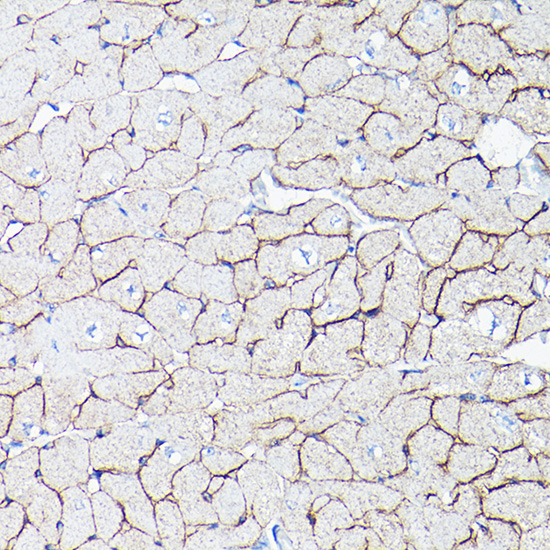 a00069 dmd primary antiboties ihc testing 2