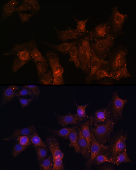 a00069 dmd primary antiboties ihc testing 3