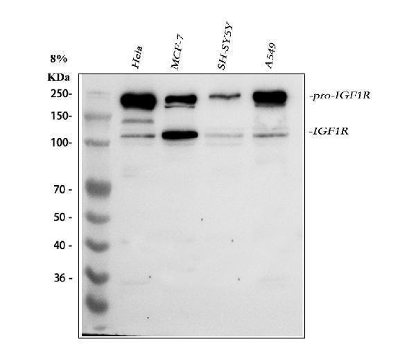  Western blot analysis of IGF1R using anti-IGF1R antibody (A00070-3)