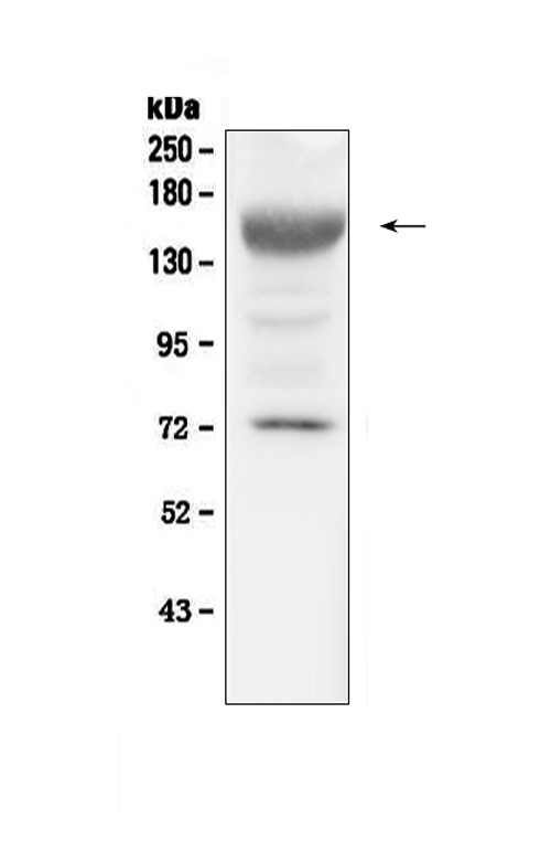 a00070 igf1_receptor primary antibodies wb testing 1