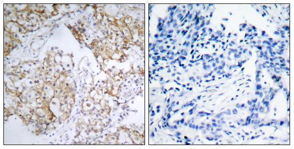 a00070y1161 1 igf1r primary antibodies ihc testing 1