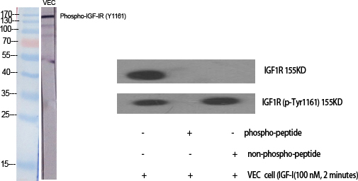 Western Blot analysis of 293 cells using Phospho-IGF-IR (Y1161) Polyclonal Antibody diluted at 1:2000