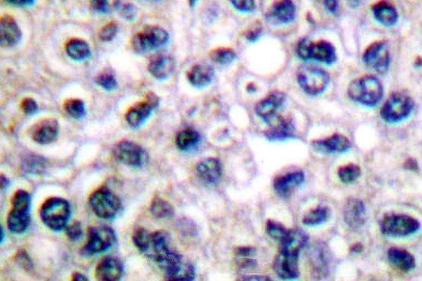 a00070y1161 igf1r primary antiboties ihc testing 2