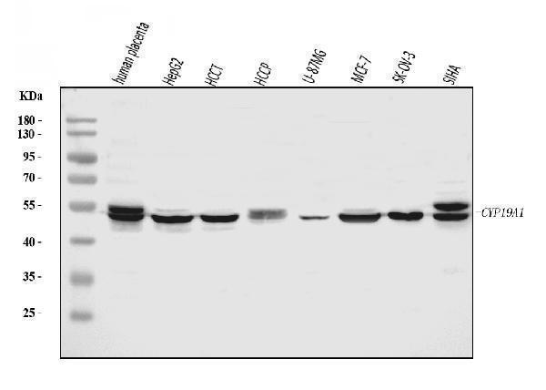  Western blot analysis of Aromatase/Cyp19a1 using anti-Aromatase/Cyp19a1 antibody (A00071-2)