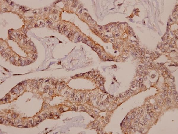 a00072 adrb2 primary antiboties ihc testing 2