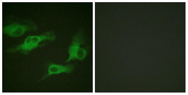 Immunofluorescence analysis of HeLa cells, using Adrenergic Receptor beta2 (Phospho-Ser346) Antibody
