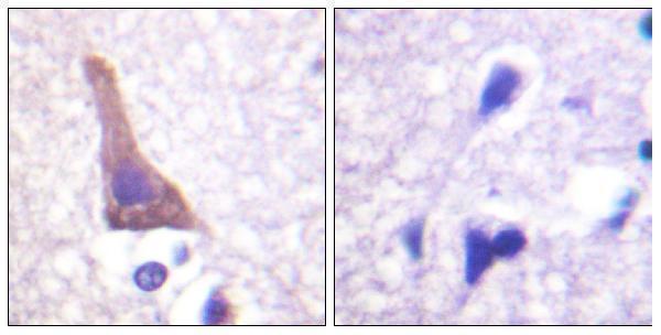 Immunohistochemistry analysis of paraffin-embedded human brain, using Adrenergic Receptor beta2 (Phospho-Ser346) Antibody