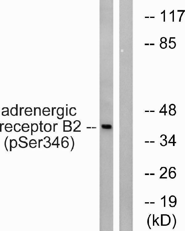 Western blot analysis of lysates from HepG2 cells treated with nocodazole 1ug/ml 16h, using Adrenergic Receptor beta2 (Phospho-Ser346) Antibody