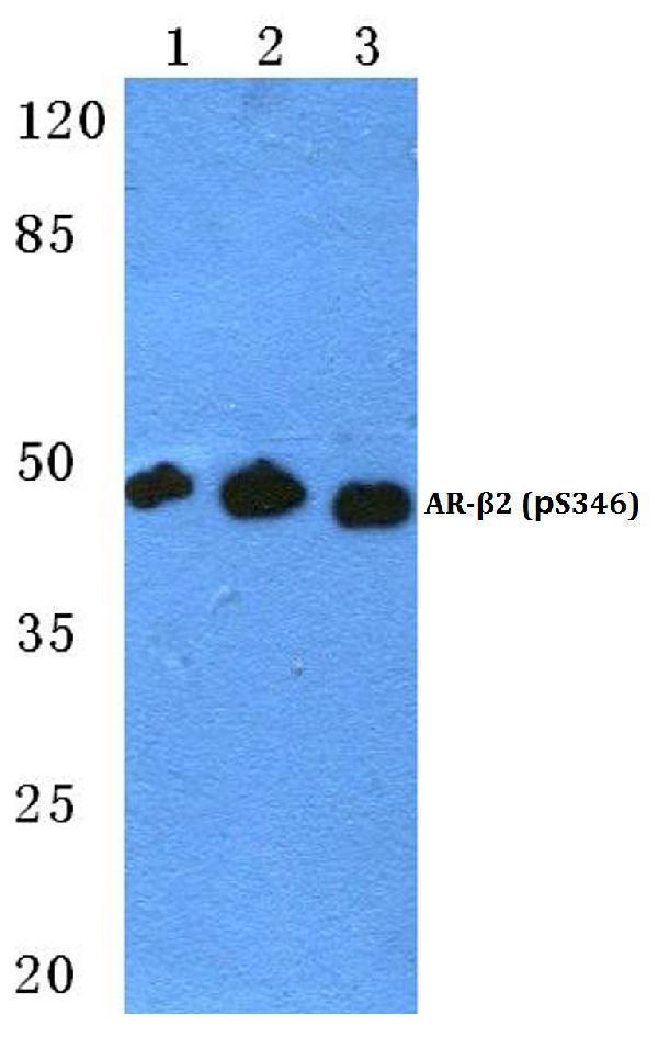 Western blot (WB) analysis of p-AR-β2 (S346) polyclonal antibody at 1:500 dilution
Lane1:HepG2 cell lysate treated with PMA(100nM,30mins)
Lane2:Mouse spleen tissue lysate
Lane3:Rat spleen tissue lysate
