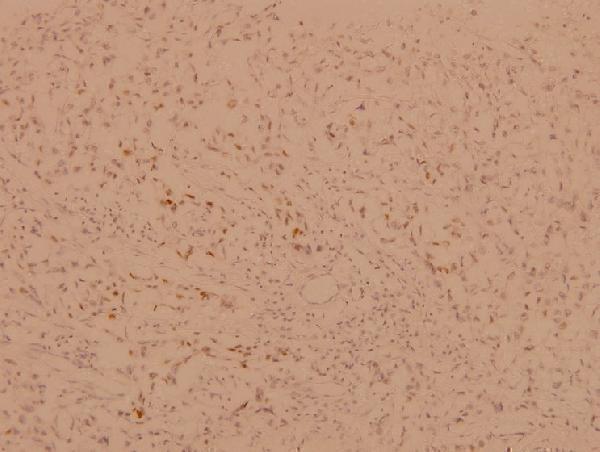 a00073 1 foxo1 primary antiboties ihc testing 2