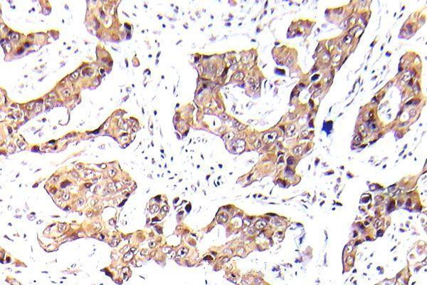 a00073s256 1 foxo1 primary antiboties ihc testing 2