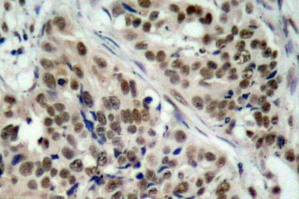 a00073s256 foxo1 primary antiboties ihc testing 2