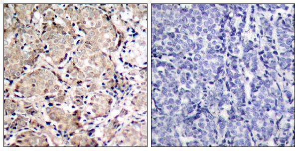 a00073s319 foxo1 primary antibodies ihc testing 5
