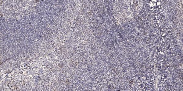 a00073s322s325 foxo1 primary antibodies ihc testing 1