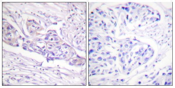 a00073s329 foxo1 primary antibodies ihc testing 1