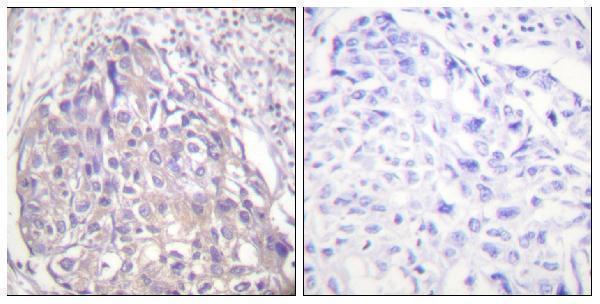 a00073t24 1 foxo1 primary antibodies ihc testing 1