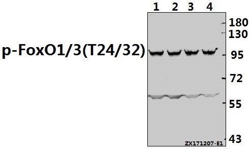 Western blot (WB) analysis of p-FoxO1/3/4 (T24/32) pAb at 1:500 dilution
Lane1:HepG2 whole cell lysate(40ug)
Lane2:Hela whole cell lysate(40ug)
Lane3:A2780 whole cell lysate(40ug)
Lane4:L02 whole cell lysate(40ug)