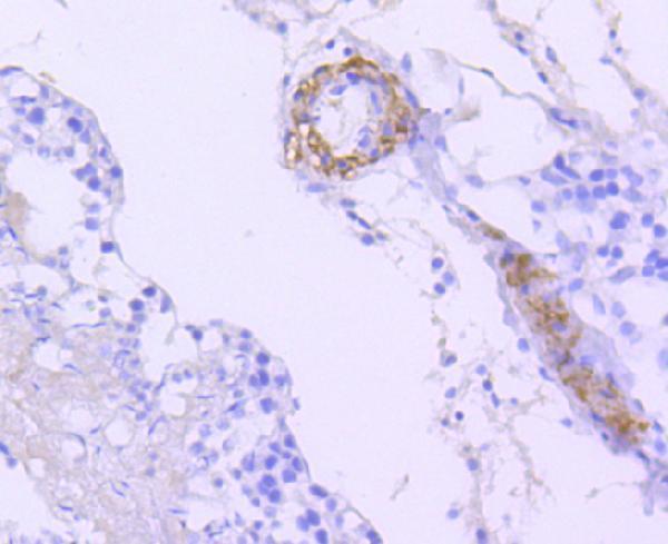 Immunohistochemical analysis of paraffin-embedded rat testis tissue using anti-B Raf antibody