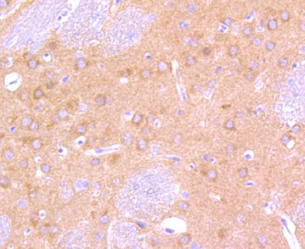 Immunohistochemical analysis of paraffin-embedded rat brain tissue using anti-B Raf antibody