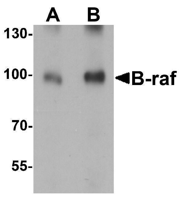 Western Blot Validation in Human Brain Tissue
Loading: 15 μg of lysates per lane