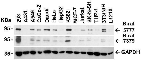 Independent Antibody Validation (IAV) via Protein Expression Profile in Cell Lines
Loading: 15 μg of lysates per lane